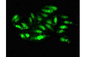 Immunofluorescent analysis of Hela cells using ABIN7150624 at dilution of 1:100 and Alexa Fluor 488-congugated AffiniPure Goat Anti-Rabbit IgG(H+L) (Mre11 antibody  (AA 1-205))