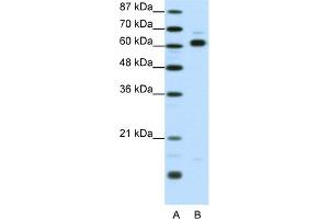 WB Suggested Anti-TRIP4 Antibody Titration:  1.