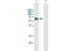 Western Blot analysis of PKNOX1 expression in transfected 293T cell line by PKNOX1 MaxPab polyclonal antibody. (PKNOX1 antibody  (AA 1-436))