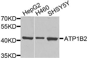 Western blot analysis of extracts of various cell lines, using ATP1B2 antibody. (ATP1B2 antibody)