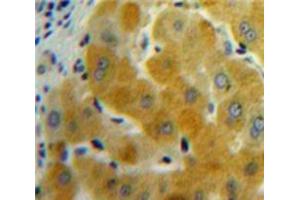 Used in DAB staining on fromalin fixed paraffin-embedded Liver tissue (GDF11 antibody  (AA 138-386))