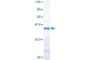 Image no. 1 for Protein Tyrosine Phosphatase Type IVA, Member 3 (PTP4A3) (AA 1-148) protein (GST tag) (ABIN1316805) (PTP4A3 Protein (AA 1-148) (GST tag))