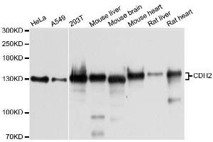 Western blot analysis of extracts of various cell lines, using CDH2 antibody. (N-Cadherin antibody  (AA 750-850))