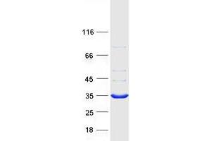 Validation with Western Blot (DNAJC27 Protein (Myc-DYKDDDDK Tag))