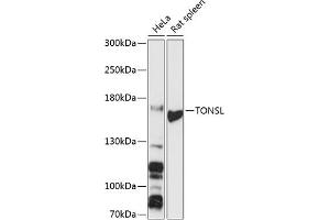 Western blot analysis of extracts of various cell lines, using TONSL antibody (ABIN6132818, ABIN6149388, ABIN6149389 and ABIN6216872) at 1:3000 dilution.