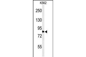 Western blot analysis of PLA2G4B Antibody in K562 cell line lysates (35ug/lane) (PLA2G4B antibody  (AA 396-424))