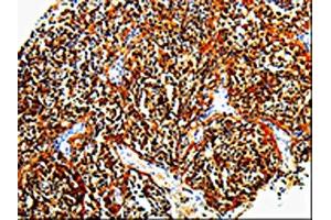 The image is immunohistochemistry of paraffin-embedded Human tonsil tissue using ABIN7131379(TLR7 Antibody) at dilution 1/10. (TLR7 antibody)