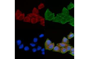 ABIN6258910 and ABIN6275186 staining Hela cells(30 min of UV treatment) by IF/ICC. (HLA-DOA antibody  (N-Term))