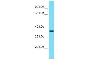 Host: Rabbit Target Name: TBATA Sample Type: Jurkat Whole Cell lysates Antibody Dilution: 1. (C10orf27 antibody  (C-Term))
