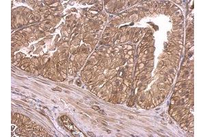 IHC-P Image Insulin Receptor antibody detects Insulin Receptor protein at membrane on mouse prostate by immunohistochemical analysis.