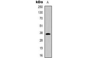Western blot analysis of CD7 expression in Jurkat (A) whole cell lysates. (CD7 antibody)
