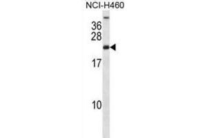 Western Blotting (WB) image for anti-Ribosomal Protein S16 (RPS16) antibody (ABIN2998333)