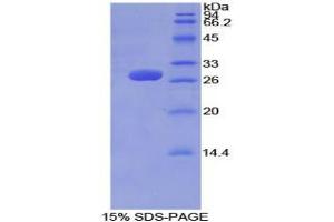 SDS-PAGE analysis of Mouse Tubulin delta Protein.