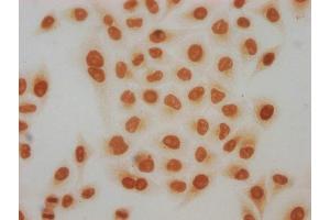 Immunocytochemistry (ICC) image for anti-Histone Cluster 1, H4a (HIST1H4A) (acLys91) antibody (ABIN7181583)