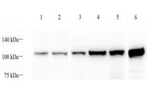 Western blot analysis of alpha Actinin (ABIN7073023) at dilution of 1: 1000,Lane 1: MCF7 cell lysate,Lane 2: Hela cell lysate,Lane 3: Mouse spleen tissue lysate,Lane 4: Mouse skeletal muscle tissue lysate,Lane 5: Mouse heart tissue lysate,Lane 6: Rat skeletal muscle tissue lysate (alpha Actinin antibody)