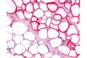 Anti-LRH-1 / NR5A2 antibody IHC of human adipocytes. (NR5A2 + LRH1 antibody  (C-Term))