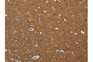 The image on the left is immunohistochemistry of paraffin-embedded Human brain tissue using ABIN7191878(PIK3CD Antibody) at dilution 1/20, on the right is treated with synthetic peptide. (PIK3CD antibody)