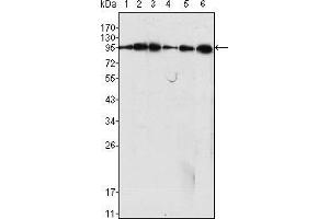 Western blot analysis using Dynamin1 mouse mAb against C6 (1), NIH/3T3 (2), SKN-SH (3), LN18 (4), SHSY5Y (5) cell lysate and rat brain tiisues lysate (6).