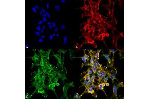 Immunocytochemistry/Immunofluorescence analysis using Mouse Anti-Citrulline Monoclonal Antibody, Clone 6C2. (Citrulline antibody  (Atto 488))
