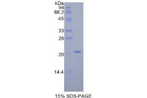 SDS-PAGE (SDS) image for Interleukin 17 Receptor E (IL17RE) (AA 457-626) protein (His tag) (ABIN2121427)
