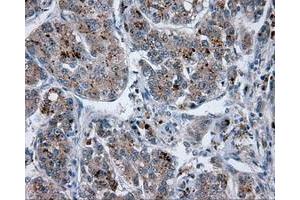 Image no. 7 for anti-Lipase, Endothelial (LIPG) antibody (ABIN1499163)