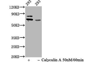Western Blot Positive WB detected in 293 whole cell lysate(treated with Calyculin A or not) All lanes Phospho-RPS6KB1 antibody at 0. (Recombinant RPS6KB1 antibody  (pSer424, pThr421))