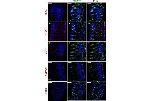 PCSK6 antibody  (Internal Region)