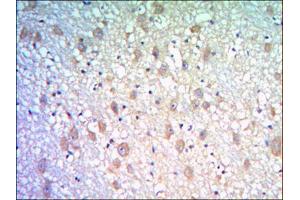 Immunohistochemical analysis of paraffin-embedded human brain tissues using KLHL21 mouse mAb with DAB staining. (KLHL21 antibody)