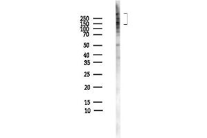 Western blot analysis of lysates from HepG2 cells(heat-shock,45 min treatment), using Nestin Antibody at 1/1000 dilution.