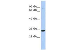 Image no. 1 for anti-Chromosome 21 Open Reading Frame 91 (C21orf91) (AA 71-120) antibody (ABIN6743397)