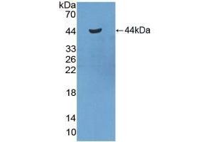 Detection of Recombinant SAA2, Mouse using Polyclonal Antibody to Serum Amyloid A2 (SAA2) (SAA2 antibody  (AA 20-122))