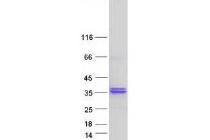 Validation with Western Blot (Ribose 5-Phosphate Isomerase A (RPIA) protein (Myc-DYKDDDDK Tag))