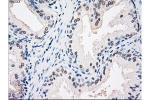 Image no. 1 for anti-Sjogren Syndrome Antigen B (SSB) antibody (ABIN1501143) (SSB antibody)