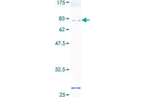 PDIA6 Protein (AA 1-440) (GST tag)