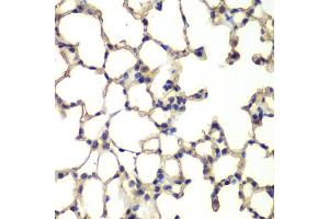 Immunohistochemistry of paraffin-embedded mouse lung using MAPK14 antibody (ABIN5998182) at dilution of 1/100 (40x lens). (MAPK14 antibody)