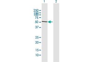 Western Blot analysis of ATG16L1 expression in transfected 293T cell line by ATG16L1 MaxPab polyclonal antibody. (ATG16L1 antibody  (AA 1-523))