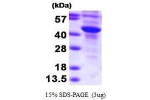 Figure annotation denotes ug of protein loaded and % gel used. (SULT2B1 Protein (AA 1-365) (His tag))