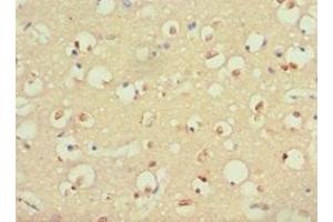 Immunohistochemistry of paraffin-embedded human brain tissue using ABIN7166082 at dilution of 1:100 (S100B antibody  (AA 1-92))