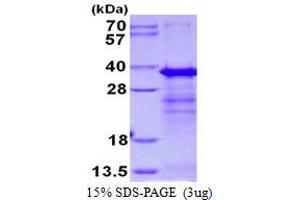 Image no. 1 for SERTA Domain Containing 1 (SERTAD1) protein (His tag) (ABIN1098643)