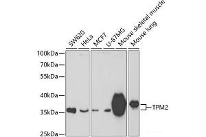 Western blot analysis of extracts of various cell lines using TPM2 Polyclonal Antibody at dilution of 1:400. (TPM2 antibody)