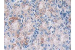 Immunohistochemistry (IHC) image for anti-Anterior Gradient Homolog 2 (Xenopus Laevis) (AGR2) (AA 21-175) antibody (ABIN7428746)