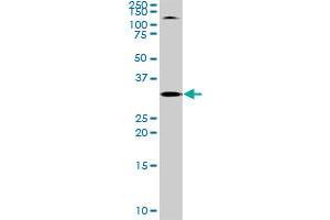 TOLLIP MaxPab rabbit polyclonal antibody. (TOLLIP antibody  (AA 1-274))