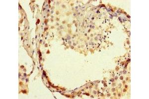Immunohistochemistry of paraffin-embedded human testis tissue using ABIN7167648 at dilution of 1:100 (RTEL1 antibody  (AA 975-1219))