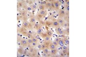 Immunohistochemistry analysis in formalin fixed and paraffin embedded human liver tissue reacted with FBXO47 Antibody (N-term) followed by peroxidase conjugation of the secondary antibody and DAB staining.