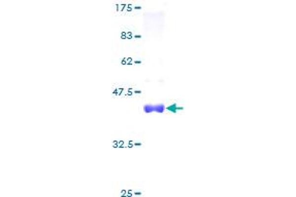 LSM3 Protein (AA 1-102) (GST tag)