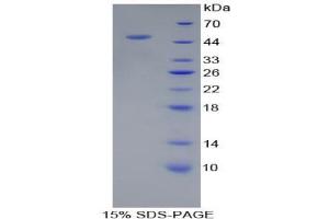 SDS-PAGE analysis of Human PSMC6 Protein.