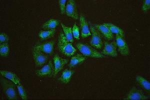 IF analysis of EIF4A using anti-EIF4A antibody (ABIN7601309). (EIF4A1 antibody  (AA 32-406))