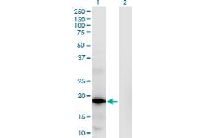 Western Blot analysis of RNASEH2C expression in transfected 293T cell line by RNASEH2C monoclonal antibody (M02), clone 5D6. (RNASEH2C antibody  (AA 1-164))