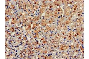 Immunohistochemistry of paraffin-embedded human adrenal gland tissue using ABIN7153422 at dilution of 1:100 (GALT antibody  (AA 1-379))