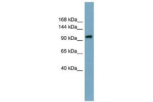 ELP2 antibody used at 1 ug/ml to detect target protein. (ELP2 antibody)